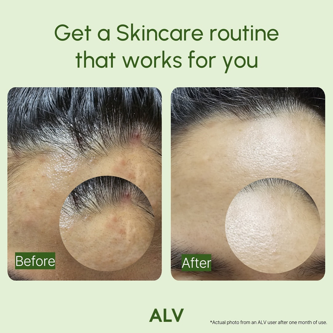 ALV TECA CALMING SERUM